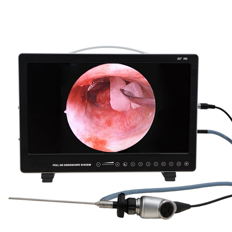 Laptop Accessories All In One - 22 Inch Endoscope Camera System 80W